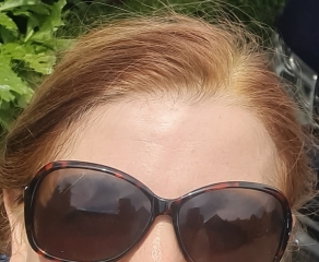 Newly allergic to hair colour, after 25 years!