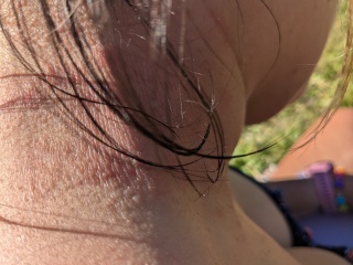 I'm finally seeing a dermatologist, what should I ask when seeing them?