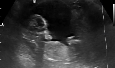 Nub / Gender - Ultrasound Tech wouldn’t commit! Opinions?