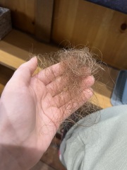 Does this look like much hair loss.