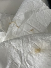 Mucus Plug
