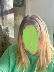 Should I give in to the bleach!