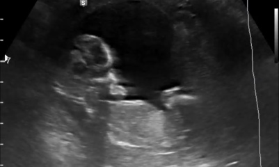 Nub / Gender - Ultrasound Tech wouldn’t commit! Opinions?