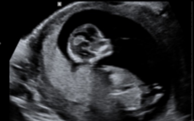 Guess the gender💖💙