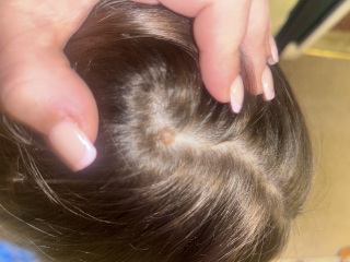 Concerned of skin mark?