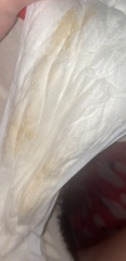 38 weeks preg, what’s this in pad?