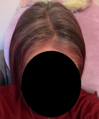 Has anyone "embraced the grey" successfully?