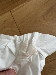 Second cycle after CP- CD16: Failed to ovulate and spotting? Help! (sensitive images!)