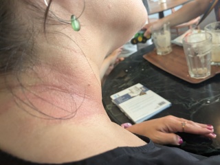 I'm finally seeing a dermatologist, what should I ask when seeing them?