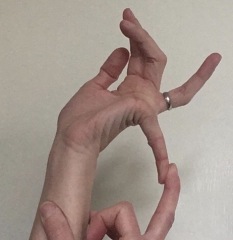 Anyone with Joint hypermobility or EDS?