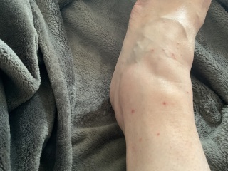 Calling all Pest Detectives! (With photo of ankles/bites)