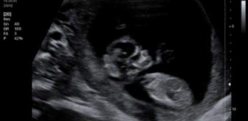 Guess the gender💖💙
