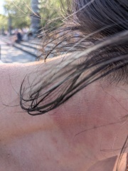 Boots nor Superdrug couldn't diagnose this, maybe one of you can?