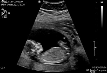 Is this a girl or a boy?