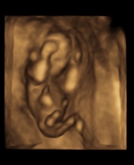 3D scan