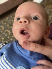 Tongue Tie?