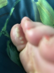 Pharmacist doesn't know what this is, do you?! (Foot)