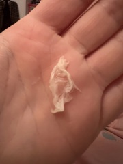 Vaginal discharge
