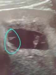 What are these on my scan?