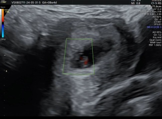 8 week abdominal scan - do I flip it?