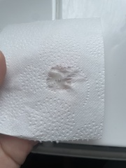 Strong smelling discharge but no answers *TW PICTURE ATTACHED*