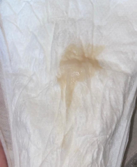 38 weeks preg, what’s this in pad?