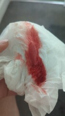 4 weeks 2 days and bleeding