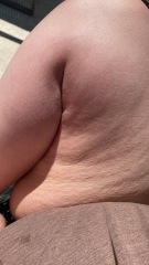 loose skin (help)