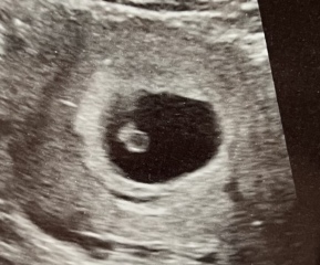 Twins on scan?