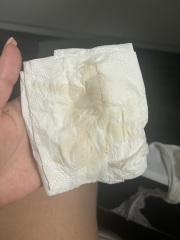 HELP! Early pregnancy discharge normal or not