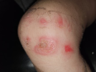 What is going on with DD's skin? Should I be worried?? Pic Attached