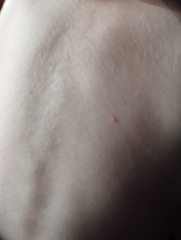 Chicken pox or something else?