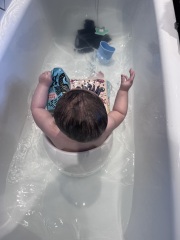 Baby abnormal head shape? - Thoughts please 