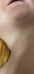Lump in 2yo neck
