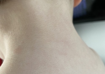 Thoughts on these spots