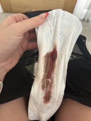 7 days brown to red bleeding? TW - IMAGES