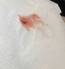 TW BLOOD PIC - advice!!