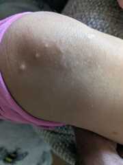 Any idea what these spots could be please?