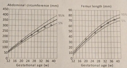 Low PAP-A Requesting a redo of final growth scan?