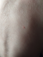 Chicken pox or something else?