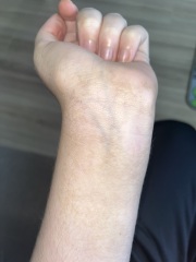 Brown stuff on skin