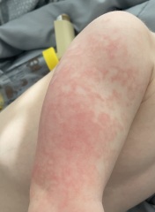 Weird rash?