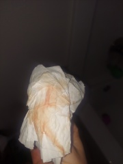 Implantation bleeding or change in menstrual cycles??