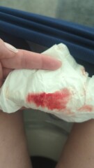 4 weeks 2 days and bleeding