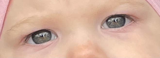 Really worried about my 9 month old… photos attached