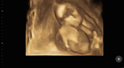 Gender help!