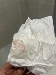 Could this be implantation bleeding??!