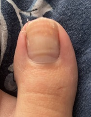 Is this fungal?