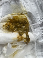 CMPA? *Graphic Poo Pic!*