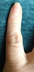 What's happening to my fingers?